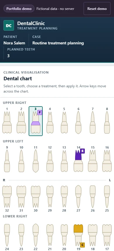 A narrow-screen view of the tooth chart with the upper and lower arches stacked and tooth numbers still legible.